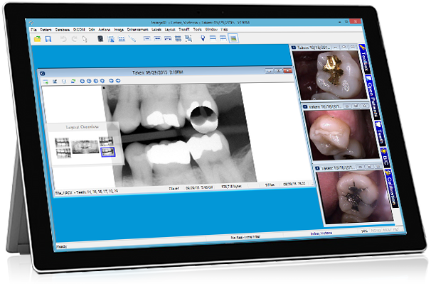 XLDent-Dental-Practice-Management-Software.png